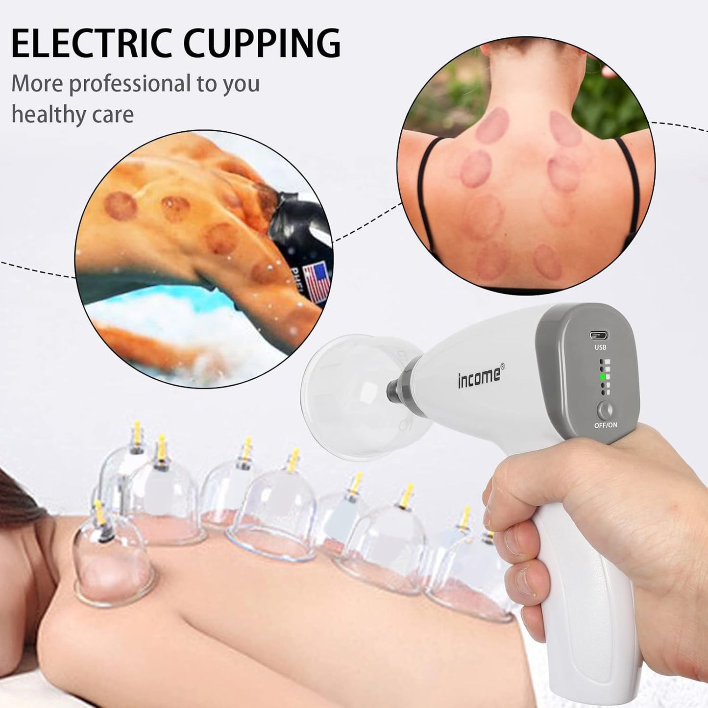 Electric Cupping Therapy Set, Portable Chinese Cupping Therapy Machine with Pump, Electric Body Massage Scraping Care Device Kit with 4 Vacuum Suction Cups for Homeuse